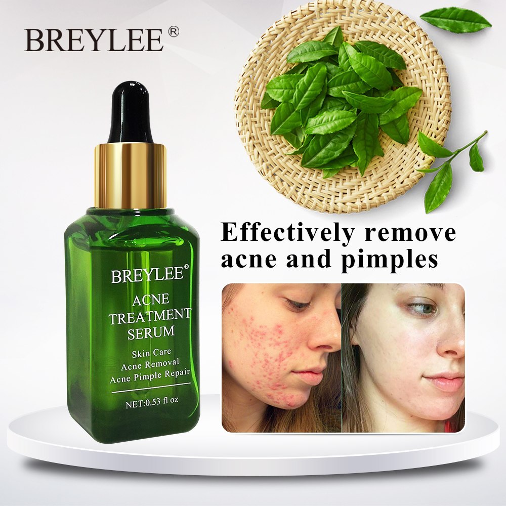 BREYLEE Acne Treatment Serum Face Skin Care
