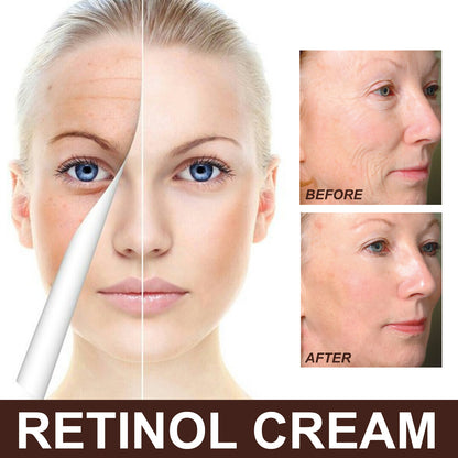 Retinol Anti Aging Wrinkle Removal Firming Cream