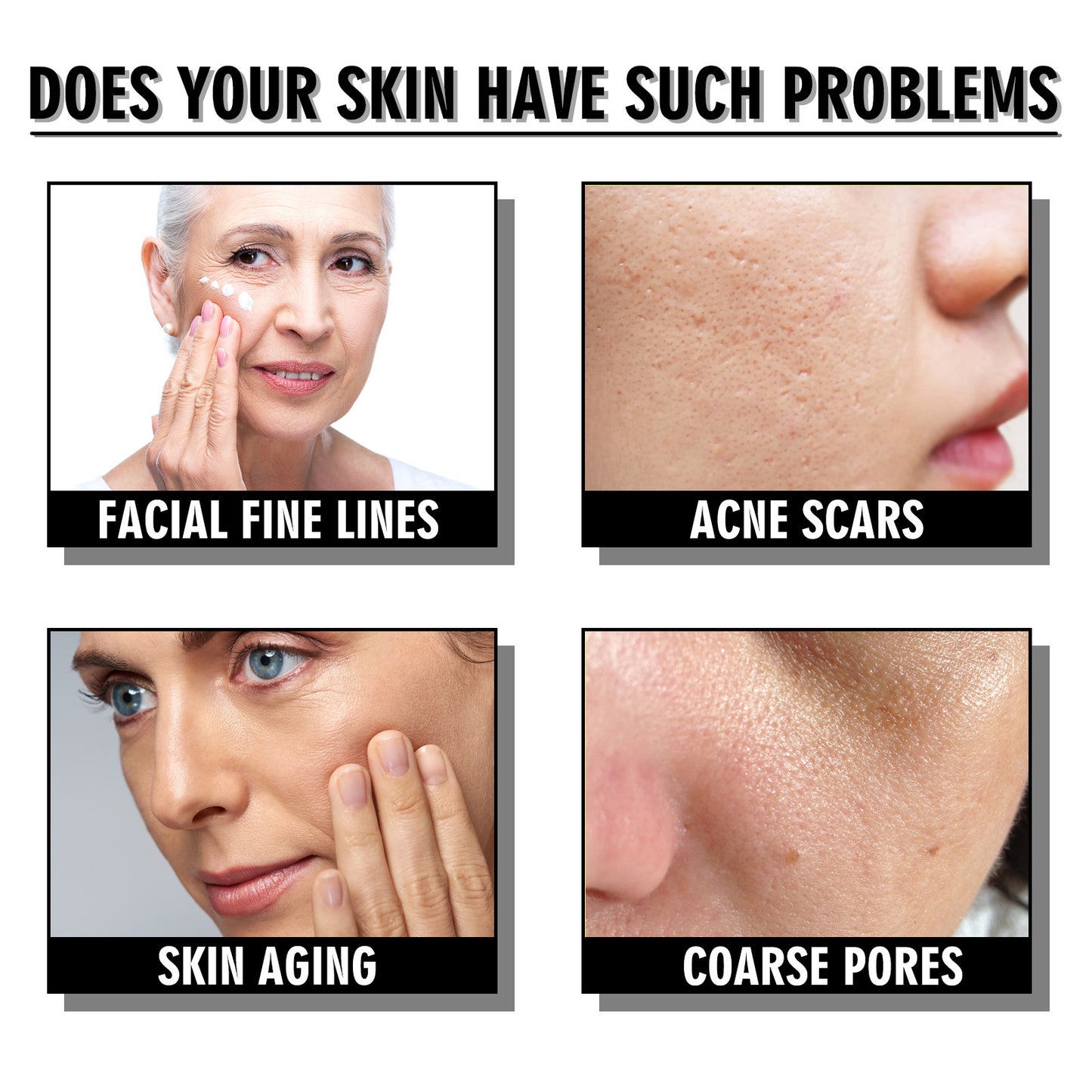 Snail Cream Fading Wrinkle Skin Anti-Aging