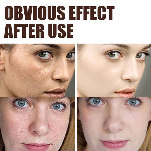 Retinol Anti Aging Wrinkle Removal Firming Cream