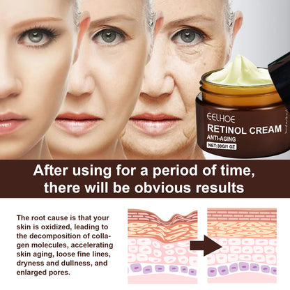 Retinol Anti Aging Wrinkle Removal Firming Cream