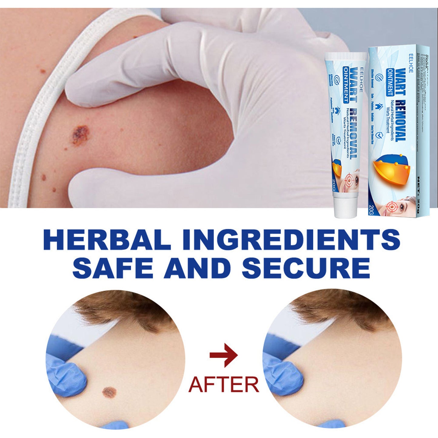 EELHOE Fragrance Removing Cream, Skin Repair